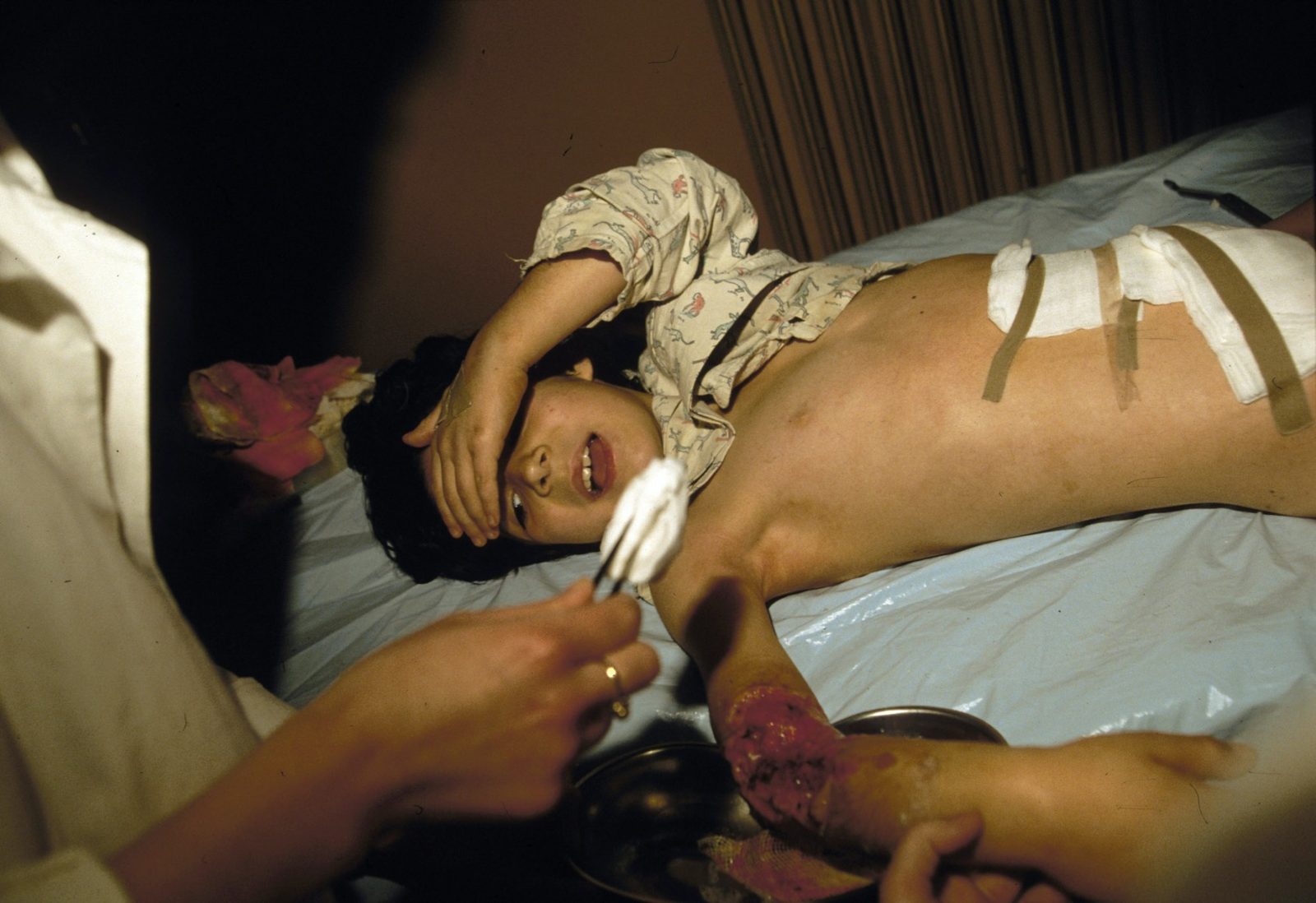 1.601 children were killed in Sarajevo. More than 50.000 persons were wounded, a great number of whom remain invalids. The siege of the city lasted from May 2, 1992 to February 26, 1996 or 1.395 days, which is the longest siege in the modern history of mankind.