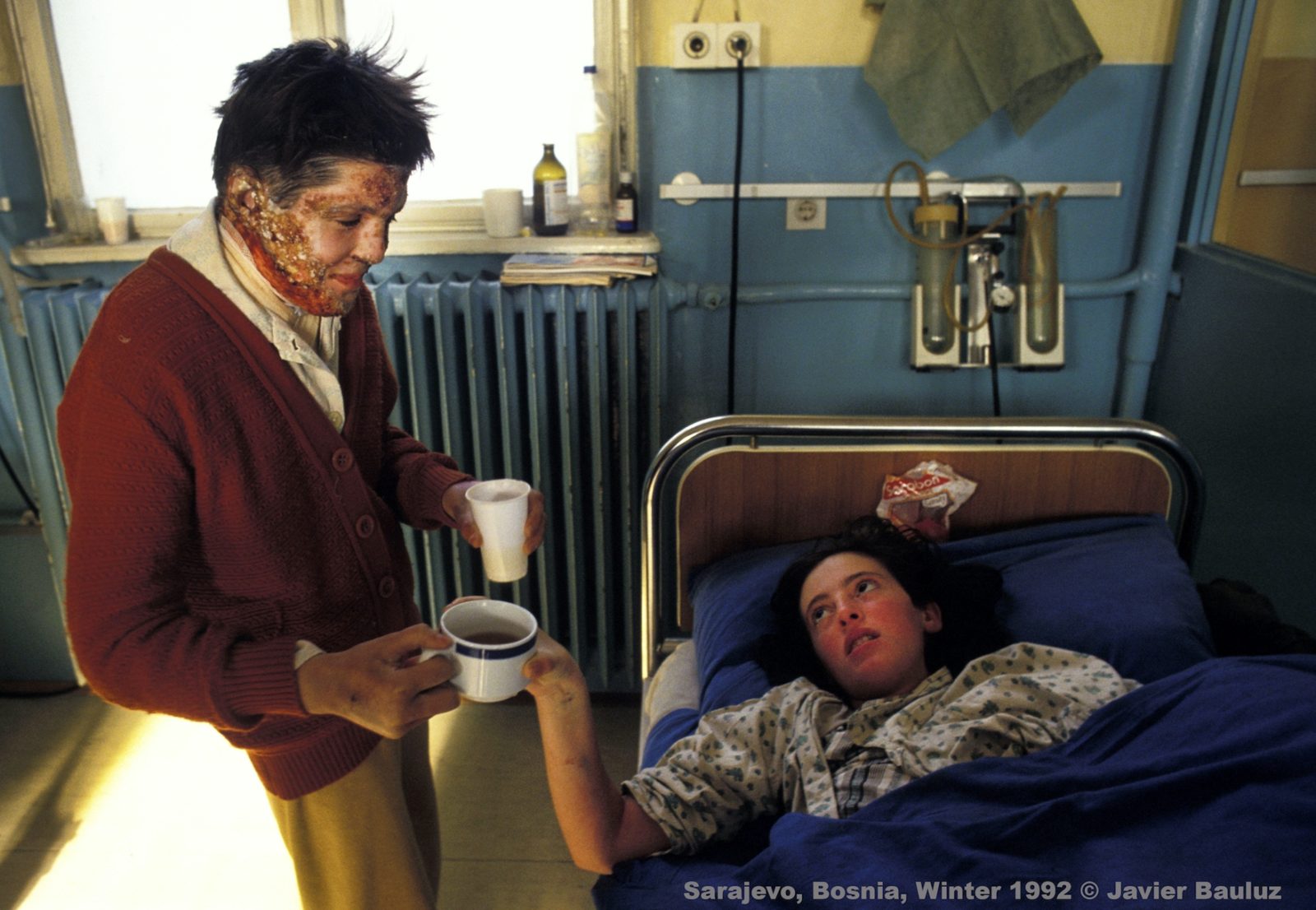The girl who gave me her candies, was seriously wounded in the abdomen in a Serb attack, receives a cup of tea from another wounded child. Sarajevo Bosnia and Herzegovina, Winter 1992.