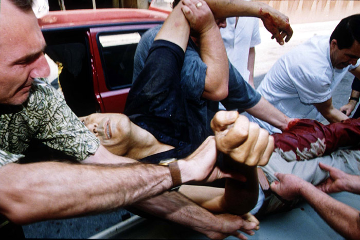 A victim of a mortar attack delivered to a Sarajevo hospital in 1992.