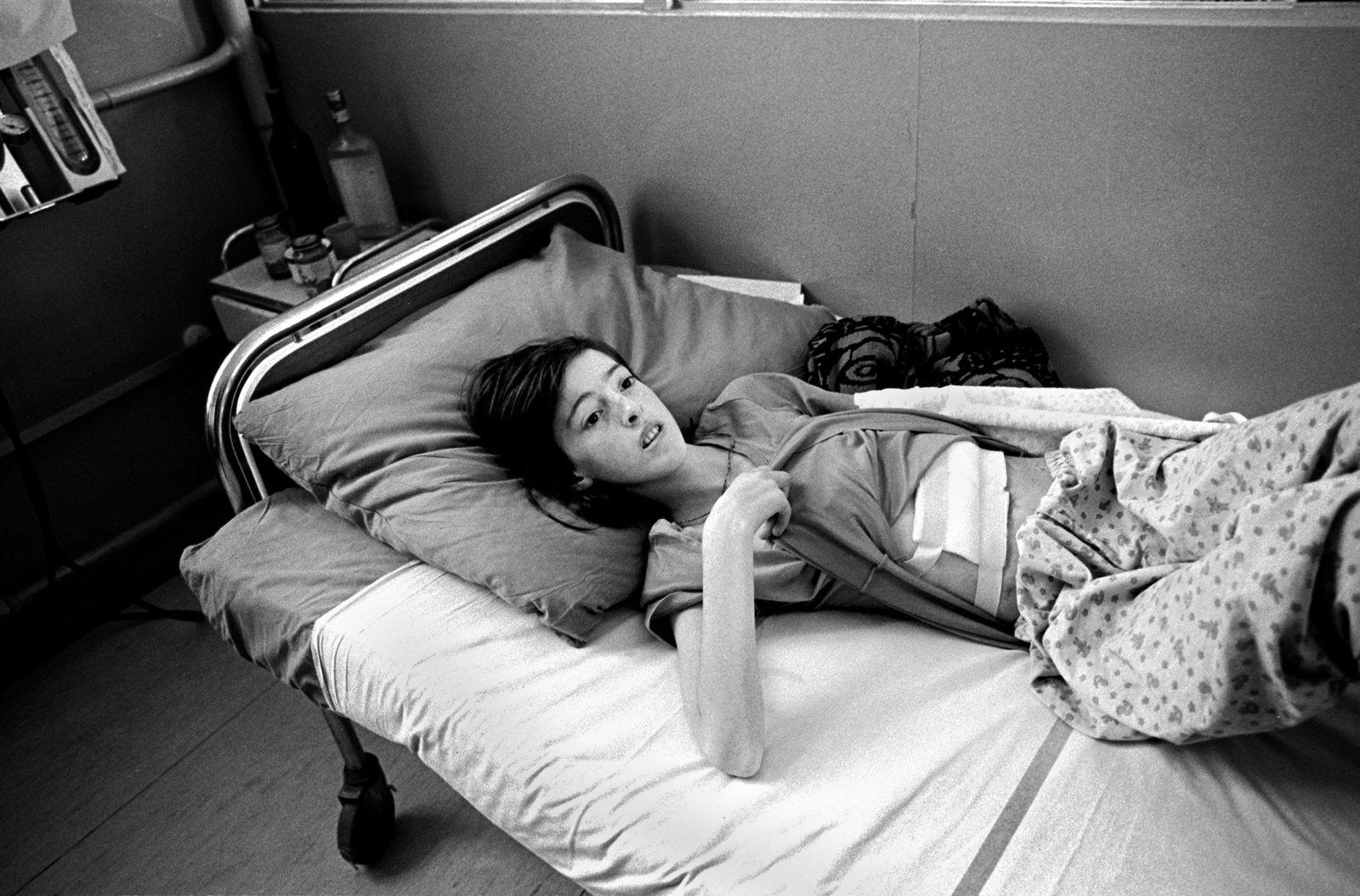 Almira Lugic, 12-years-old, lies in Kosevo Hospital with a grave stomach wound caused from a Serb shell that fell as she was collecting water, Sarajevo, Bosnia-Herzegovina, February 1993.