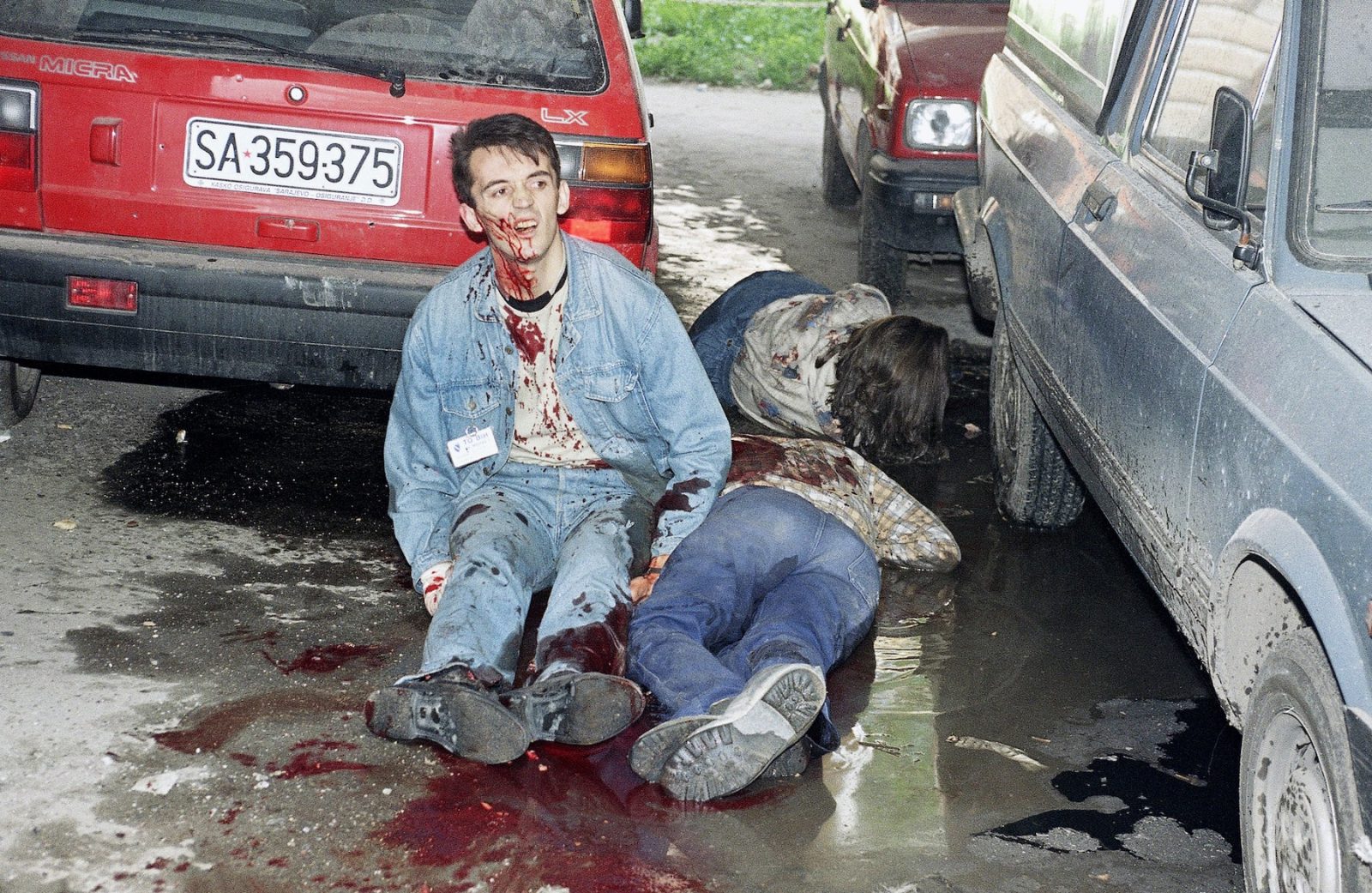 A wounded Sarajevo resident sits in shock next to two other seriously wounded civilians moments after one of several mortar shells landed in central Sarajevo on Monday, June 22, 1992. At least five people were killed and 25 wounded in the late morning shelling.
