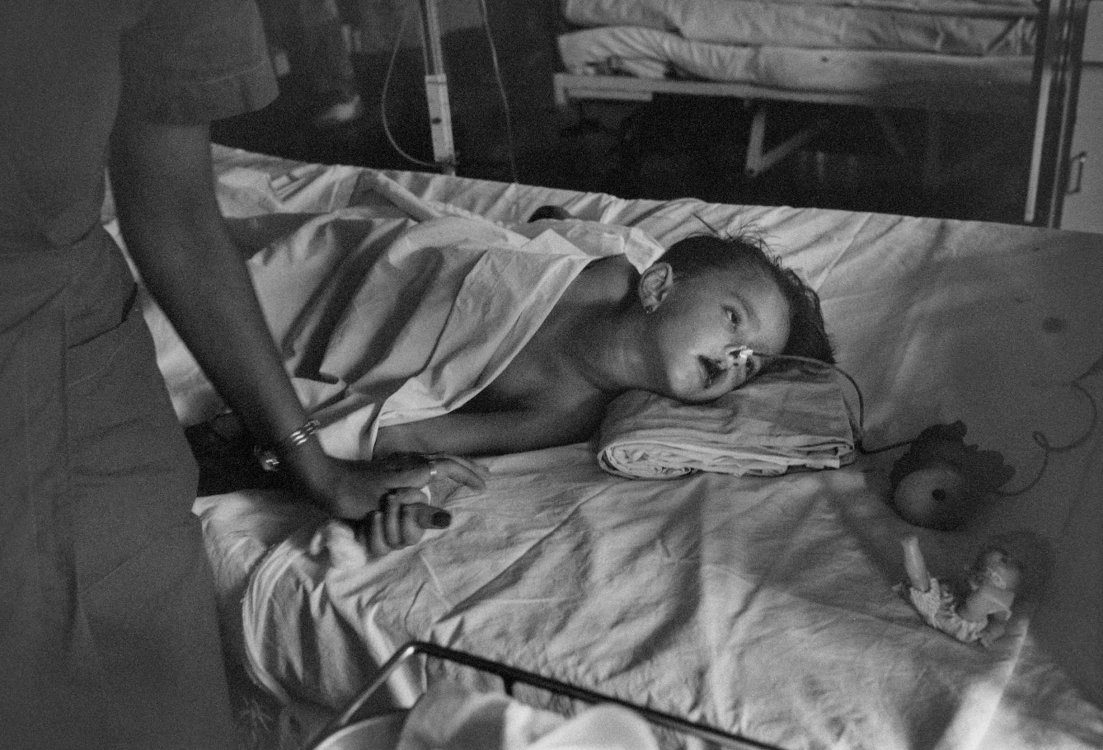 Irma Hadzimuratovic whose suffering has come to symbolise the agony of Bosnia, lies on a hospital bed. 5 year old Irma was seriously injured by a Serbian mortar bomb which killed her mother and 14 others in a market square in Bosnia's capital, Sarajevo in august 1993. She was eventually airlifted to the UK where she was treated but sadly died there in 1995.
